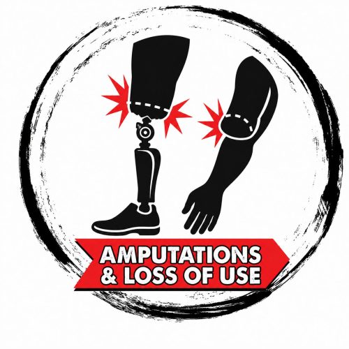 An icon for amputation and loss of use after a severe injury.