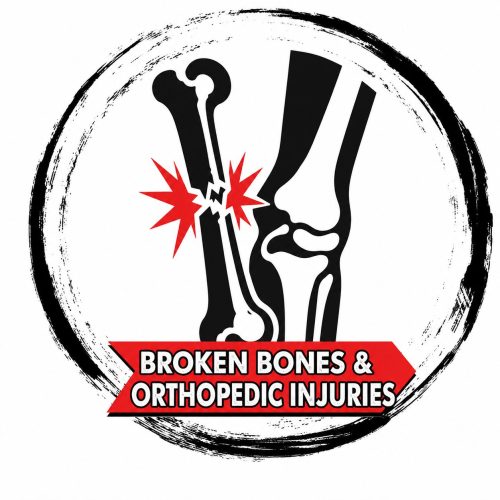 An icon for broken bones and orthopedic injuries